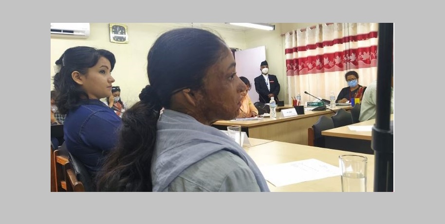 एसिड आक्रमणको दण्ड सजाय परिमार्जन गर्न निर्देशनः मुस्कान भन्छिन्– ‘सपना जिवित छन्, सरकारले सहयोग गर्नुपर्छ’