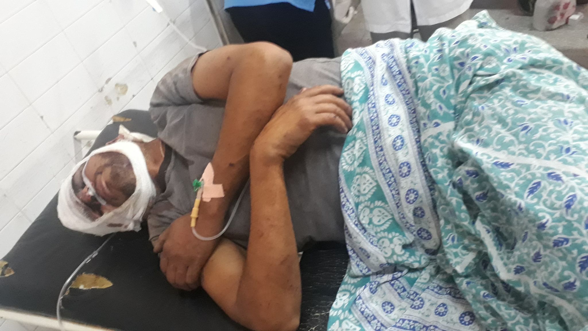 धरान ४ कोसी राजमार्गमा ट्रिपर दुर्घटना, एक जना गम्भीर घाइते