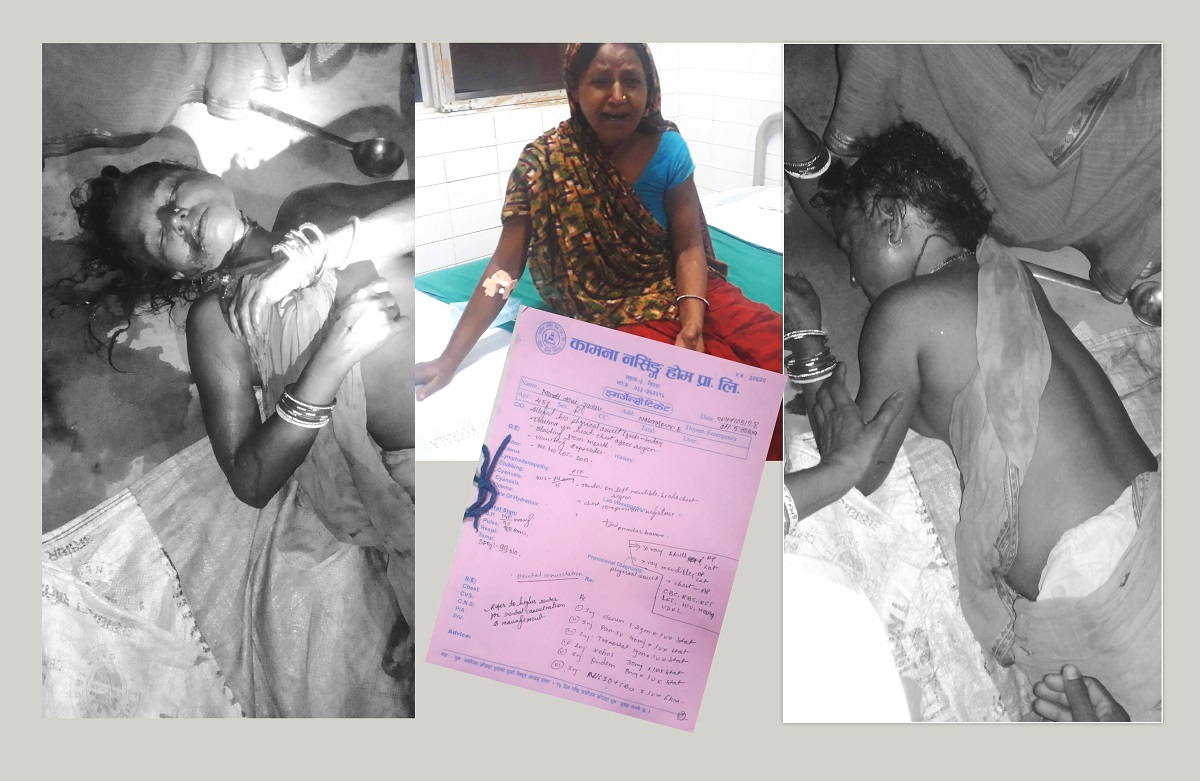 बोक्सीको आरोपमा महिलामाथि कुटपिट, पहुँचकाे धक्कु लगाउँदै अर्काे मुद्दामा फसाउने धम्की !
