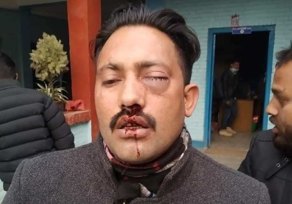 बानेश्वरमा प्रहरीबाट कुटिए विद्यार्थी नेता
