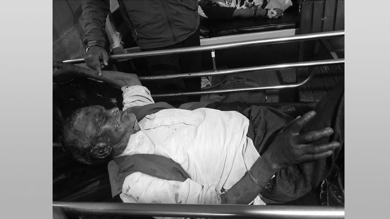 अरिङ्गालको टोकाइबाट वृद्धको मृत्यु