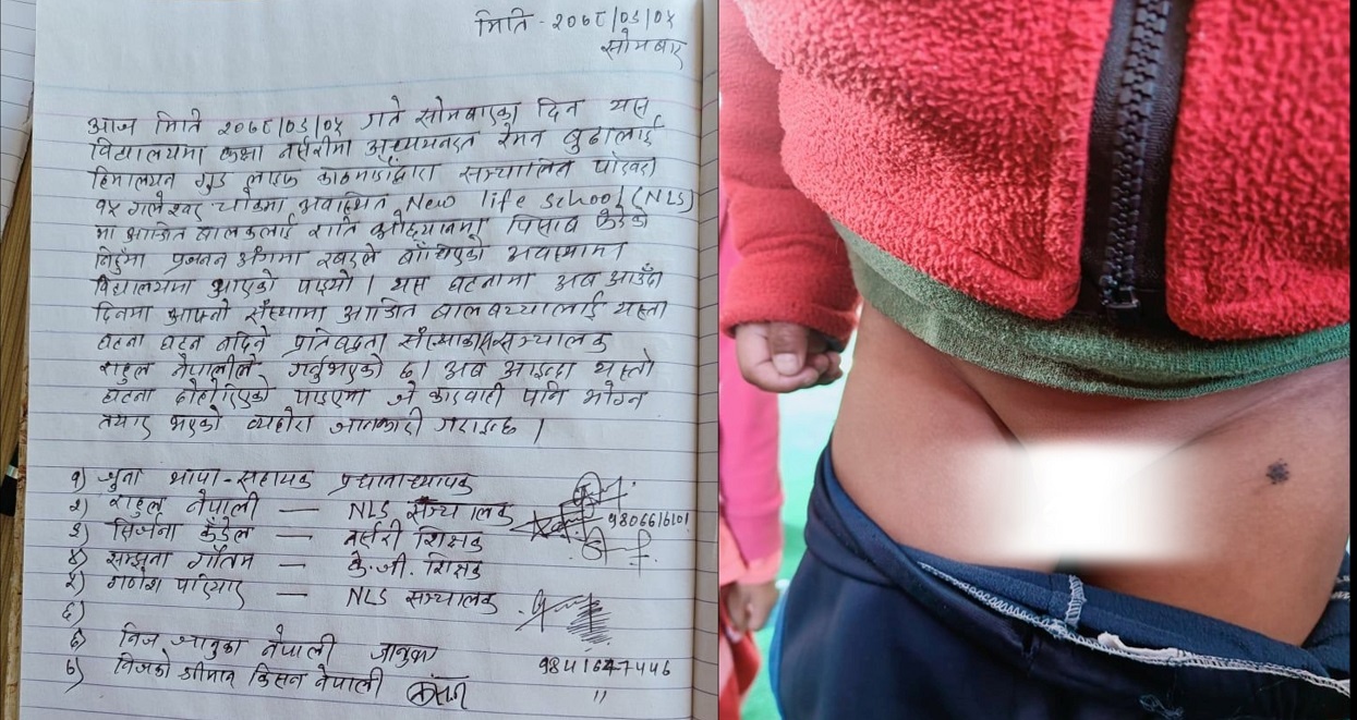 ओछ्यानमा पिसाब फेरेको भन्दै वार्डेनले बालकको लिङ्ग बाँधिदिएपछि…