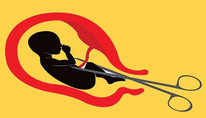 सर्लाहीमा महिलाको जनसङ्ख्या घट्दो, लिङ्ग पहिचान गर्दै भ्रूण हत्या