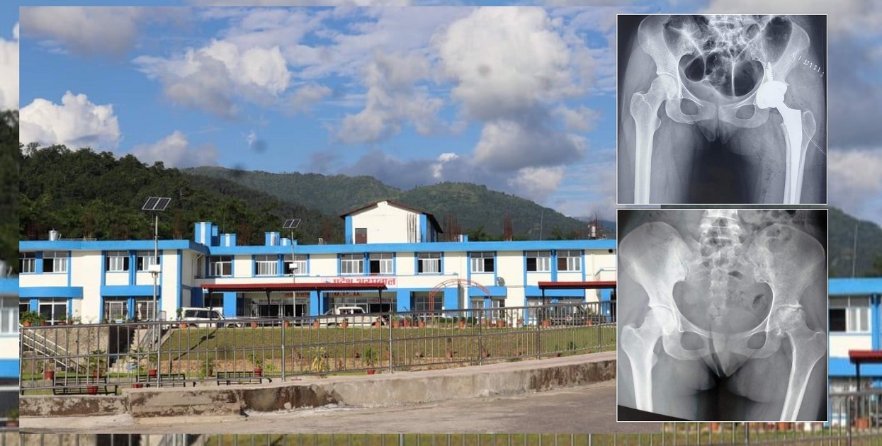 ‘नागरिक सेवा’मा फड्को मार्दै प्रदेश अस्पताल