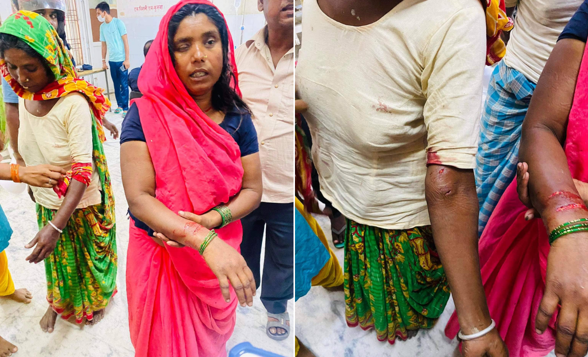 राेकिएन हिंस्रक स्यालकाे आतंक, थप २ जनालाई टोक्यो