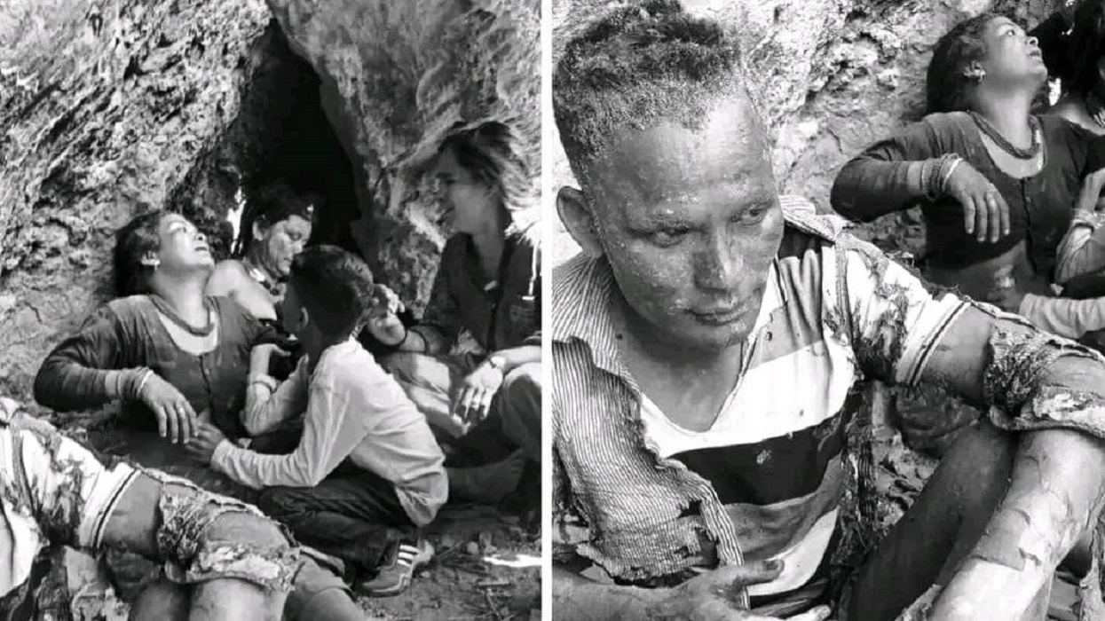 जंगलमा डढेलाे निभाउन गएका ११ जना घाइते