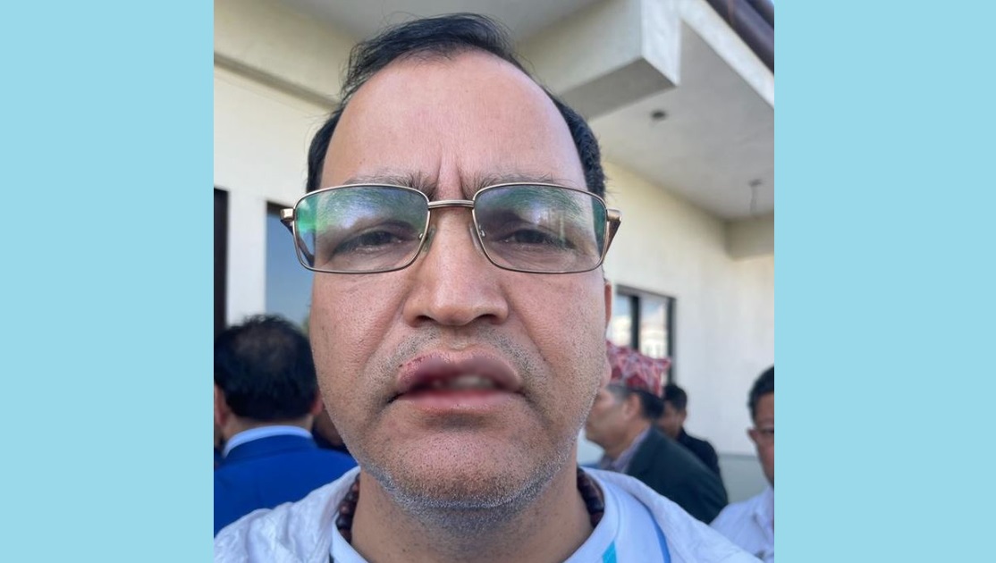 एनआरएनएका अध्यक्ष बद्री केसी र एमाले नेता महेश बस्नेतविरूद्ध प्रहरीमा उजुरी