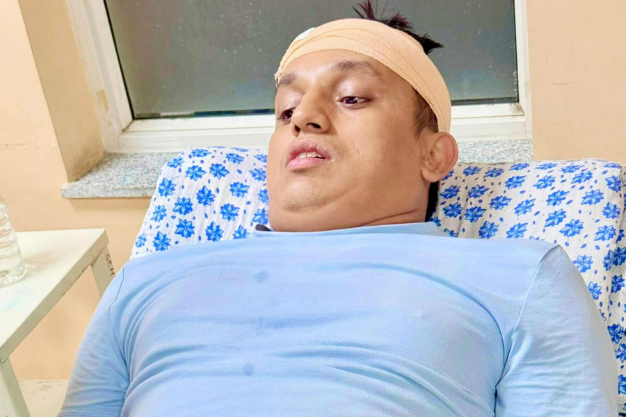 रास्वपा नेतामाथि कपनमा आक्रमण, टाउकोमा गम्भीर चोट