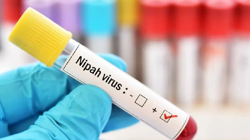 निपाह भाइरसको सङ्क्रमण फैलिन नदिन पश्चिमी नाकामा निगरानी