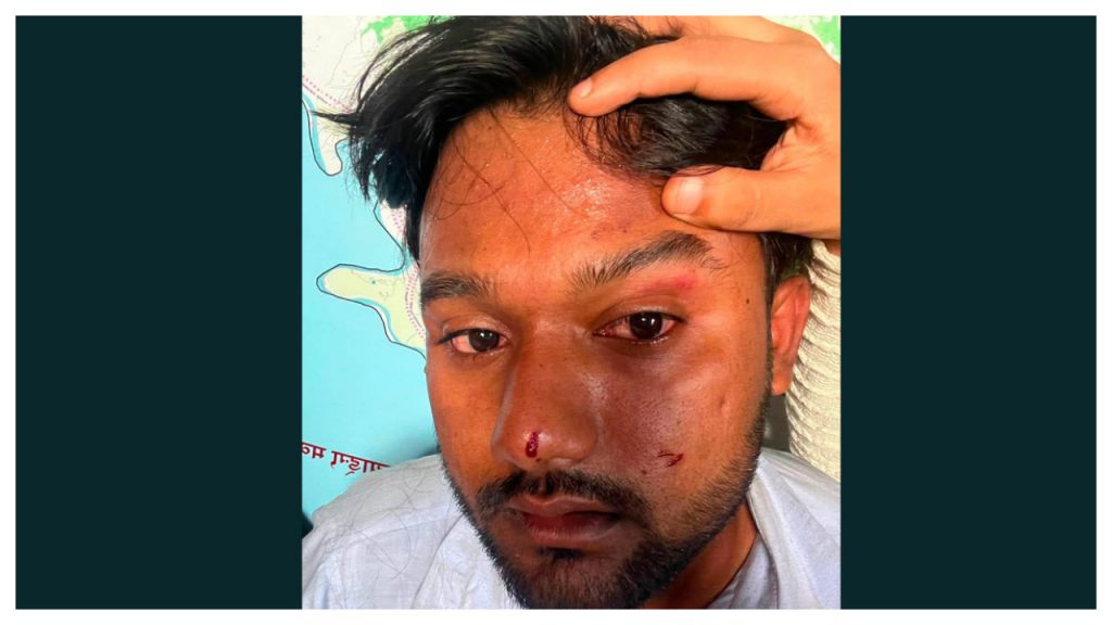 माजिद अन्सारी अस्पतालबाट डिस्चार्ज, प्रहरीले पनि छाड्यो