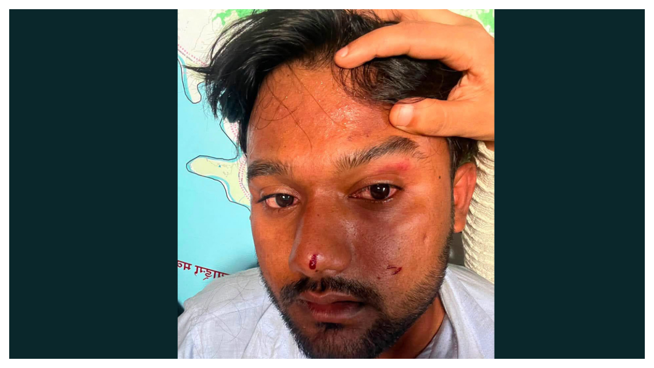 जेनजी अभियन्ता माजिद अन्सारी अस्पतालबाट डिस्चार्ज
